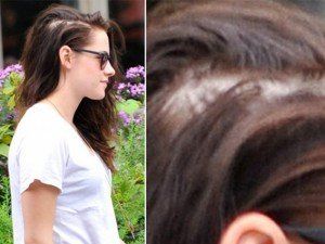 Kristen Stewart sta perdendo i capelli