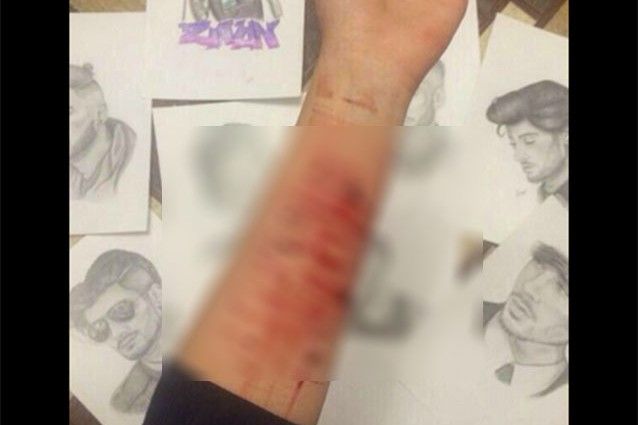 One Direction: le fan si tagliano per l'addio di Zayn Malik