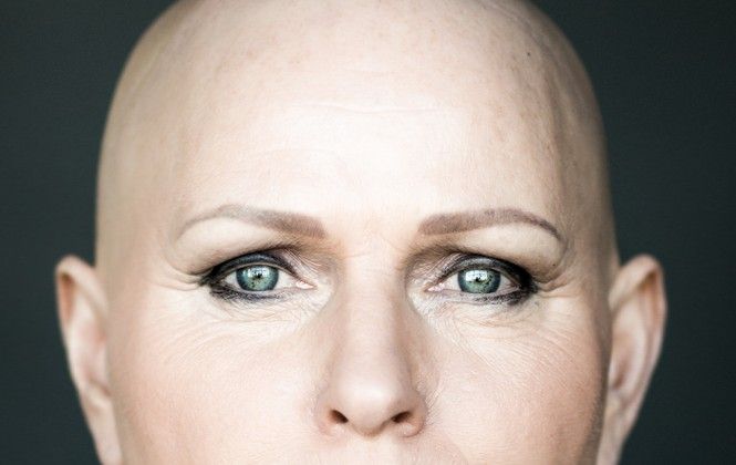 7 ritratti mozzafiato di donne femminili anche con l’alopecia