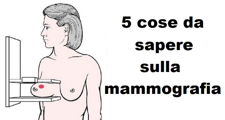 Le cose da sapere sulla mammografia