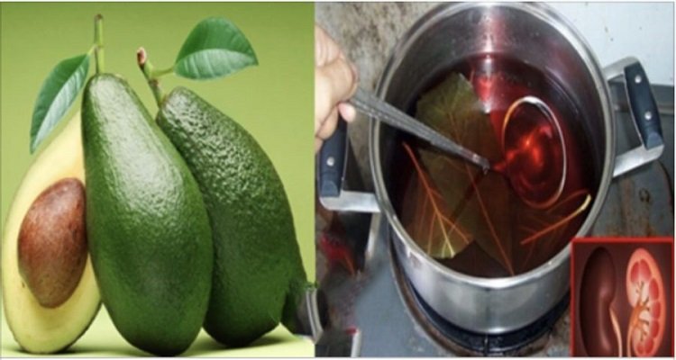 Una foglia di avocado fa miracoli per il nostro corpo. E non solo la foglia