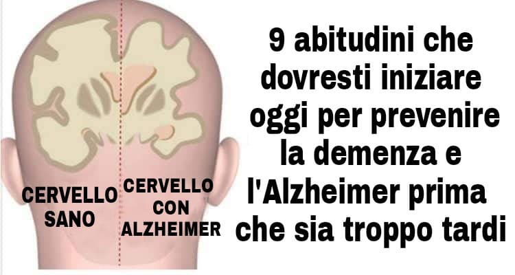 Come Prevenire L'Alzheimer - Bigodino