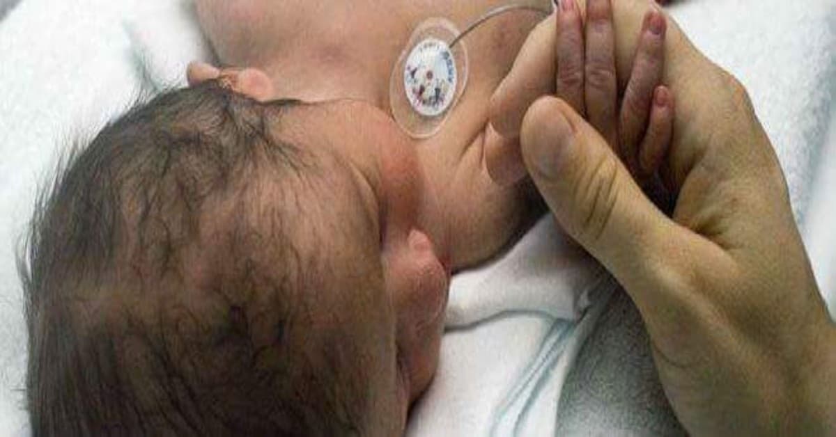 Adulto gli da un bacio, neonato di 11 giorni rischia di perdere la vita per un herpes