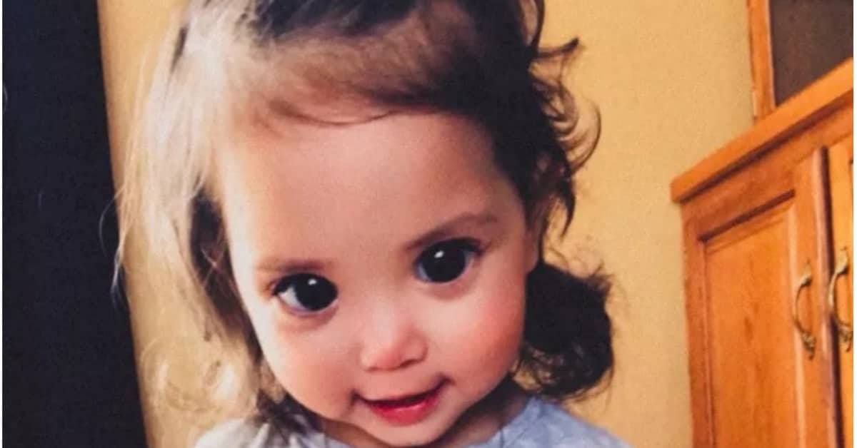 Gli occhi grandi e belli di questa bambina sono dovuti a una rara sindrome genetica