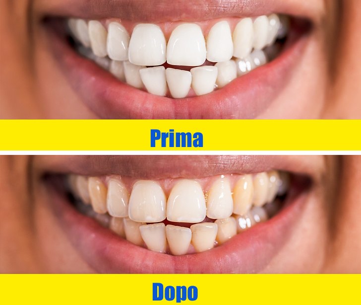 colore-denti