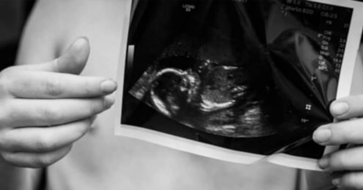 Lo sfogo di una mamma che ha accettato il suo aborto dopo mesi