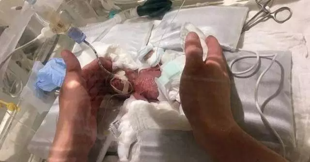 Il bambino prematuro più piccolo del mondo, torna a casa