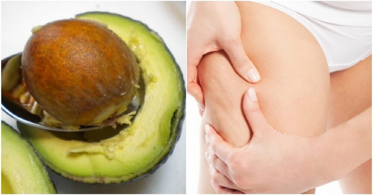 Seme di avocado contro la cellulite