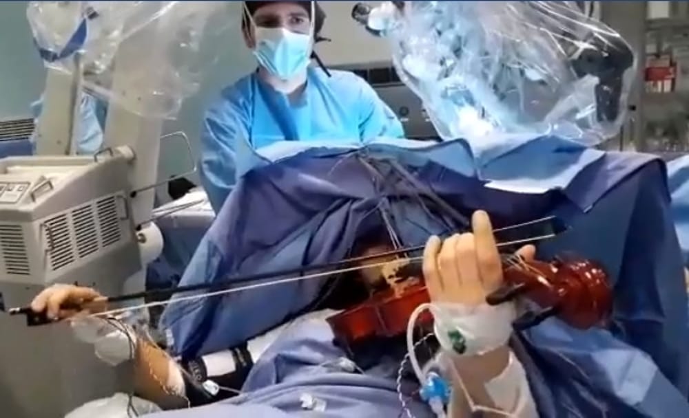 23enne operata al cervello mentre suona il violino