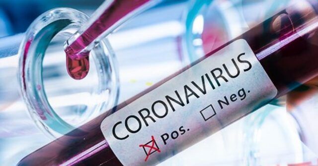 Coronavirus-donna-positiva-al-test-a-Formia-trasferita-allo-Sapallanzani