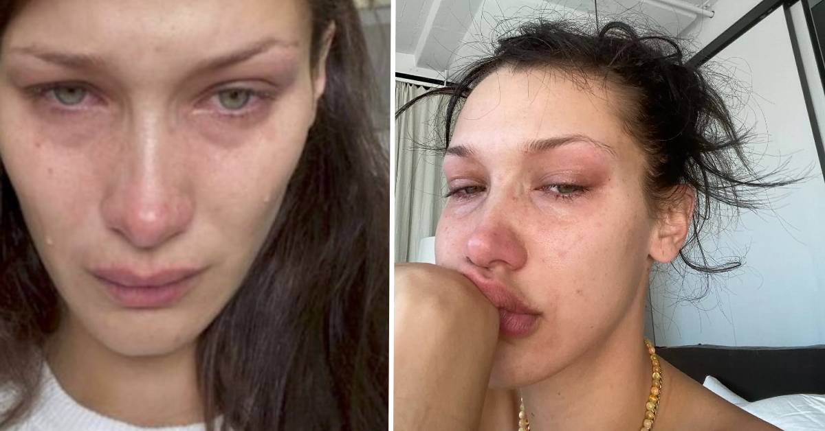 Bella Hadid e lo sfogo sui social: “Soffro di depressione”