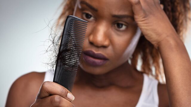 Se stai perdendo i capelli in questo periodo abbiamo dei rimedi che ti salveranno assolutamente