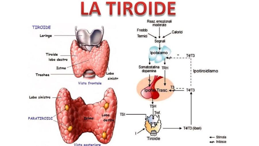 tumore tiroide