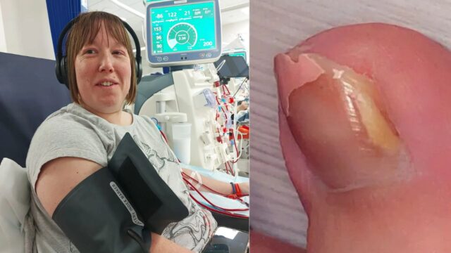 “Mi ha detto: vai da un medico” l’estetista salva la vita a questa ragazza grazie ad un pedicure: pensava fosse solo un’unghia spezzata