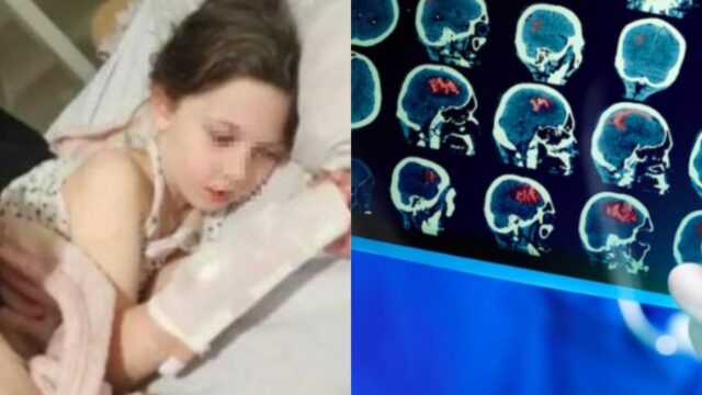 “Aveva un tumore al cervello, è stata la nonna ad accorgersi dei primi sintomi” il dramma di una bambina di 7 anni