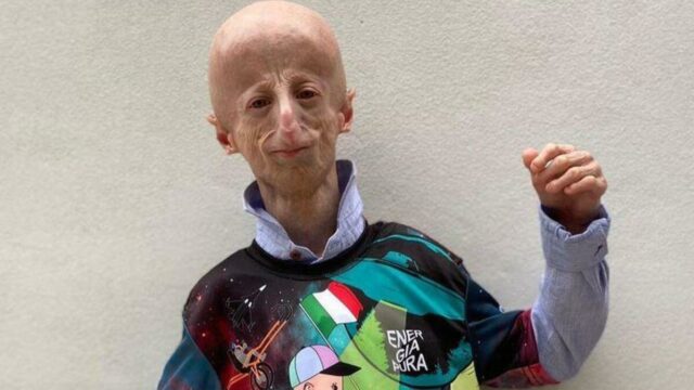 Gli ultimi istanti di vita Sammy Basso, ecco cosa ha fatto: le parole del suo migliore amico 