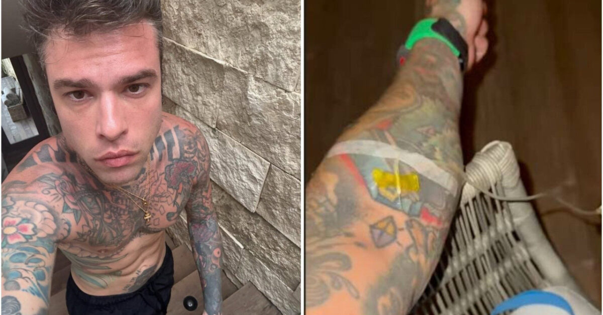 Fedez e l'IV Drips: scopri il segreto della flebo preferita delle celebrità per Capodanno